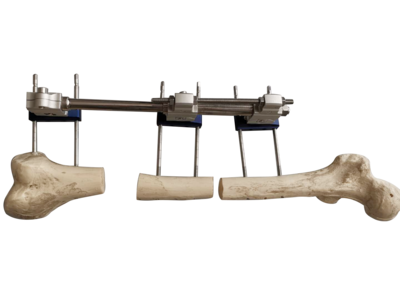 单臂式外固定支架-用于下肢延长