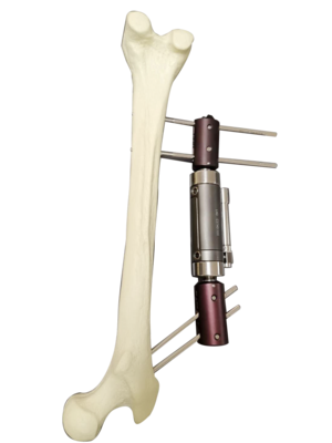 单臂式外固定支架-又名：股骨粗隆间支架